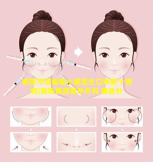 朝阳市溶脂瘦小腿医生口碑前十揭晓(朝阳医院整形外科 瘦脸针 🦄 )